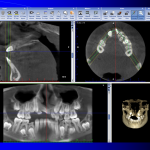 Cone Beam Computed Tomography2