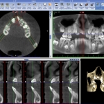 Cone Beam Computed Tomography3