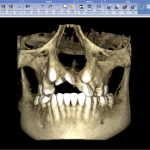 Cone Beam Computed Tomography4