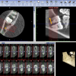 Cone Beam Computed Tomography5