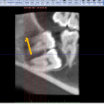 Cone Beam Computed Tomography6