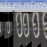 Cone Beam Computed Tomography7