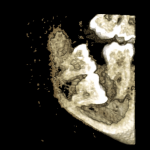 Cone Beam Computed Tomography8