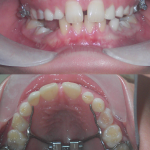 Ortodonzia&IOmpianti Osteointegrati1