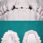Ortodonzia&ImpiantiOsteointegrati2