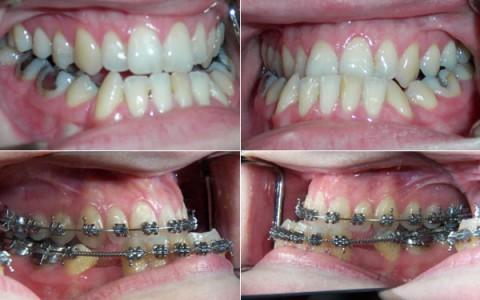 Estetica e Funzione Orale in Ortodonzia