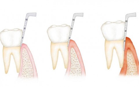 Periodontology