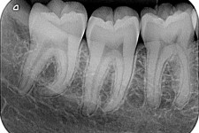 Radiografie odontoiatriche