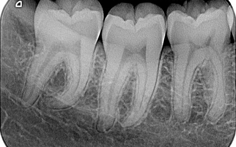 Radiografie odontoiatriche