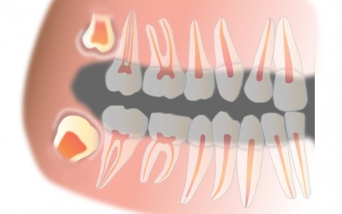 Oral Surgery