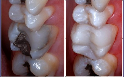 Restorative dentistry