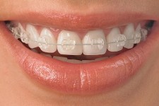 Orthodontics and Orthodontic Surgery