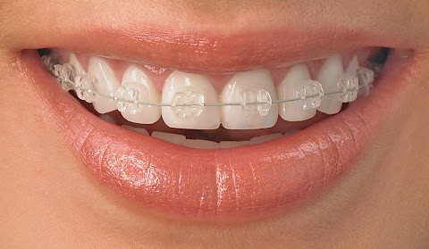 Orthodontics and Orthodontic Surgery