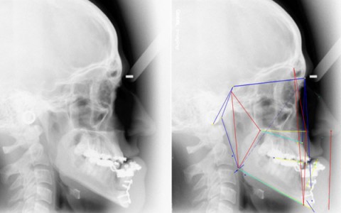 Ortodonzia e Chirurgia ortognatica IOS srl