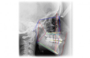 Computed aided system in the dental and orthodontic practice: clinical and organizing aspects, digital photography and radiology, instrumental diagnosis