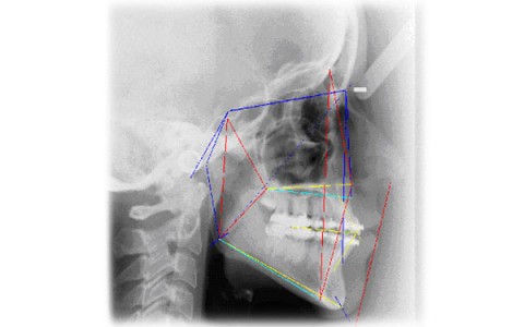 Computed aided system in the dental and orthodontic practice: clinical and organizing aspects, digital photography and radiology, instrumental diagnosis